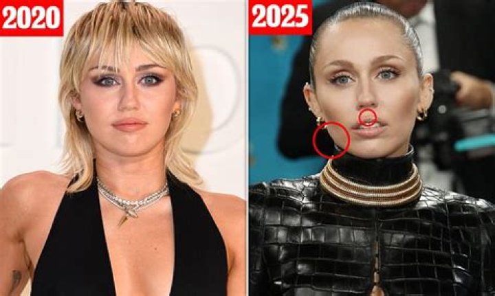 Miley Cyrus Has Vocal Surgery And Is Forbidden To Speak